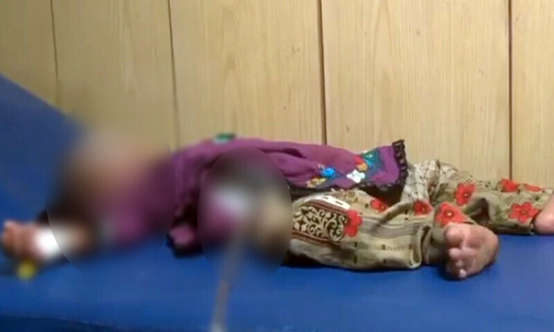 منفرد اور حیرت انگیز آپریشن،10 ماہ کی بچی کے پیٹ میں بچہ ہونے کا انکشاف