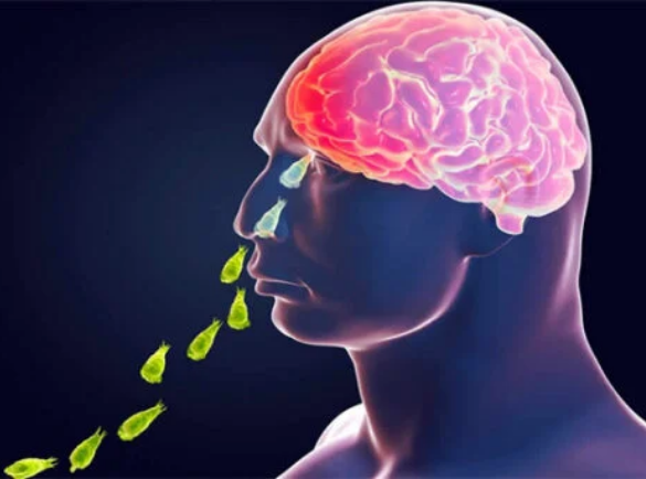 نگلیریا  جیسے موضی مرض کیلئے فوری اقدامات کی ضرورت