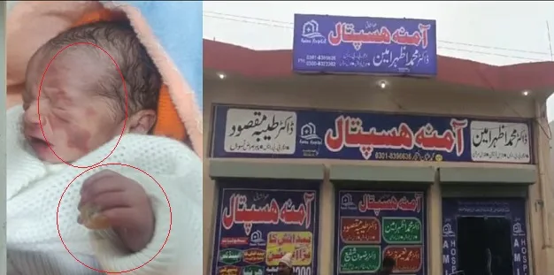 ننکانہ:مٹھائی کے پیسے نہ دینے پر نجی ہسپتال کی نرس نے مبینہ طور پر نو مولود کو ہیٹر کے آگے رکھ کر  جلا دیا