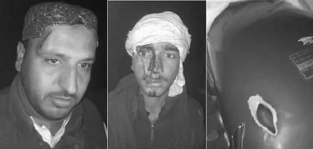 کندھ کوٹ: موٹرسائیکل ڈکیتی کی کوشش،مزاحمت پر 2 نوجوان زخمی