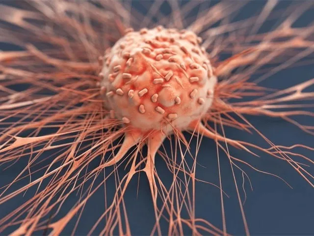 خواتین میں چھاتی کے کینسر کی بڑی وجہ دریافت