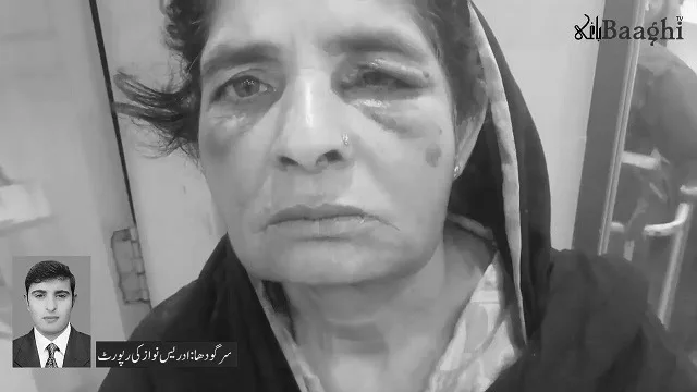 سرگودھا :گھریلو ملازمین پر تشدد ، مالکان نے گھریلو ملازمین میاں بیوی کے دانت توڑ دیے