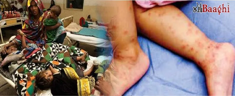 تنگوانی :خسرہ وبا ءکی شکل اختیار کر گیا ایک بچہ جاں بحق ،کئی بچے خسرہ کے مرض میں مبتلا