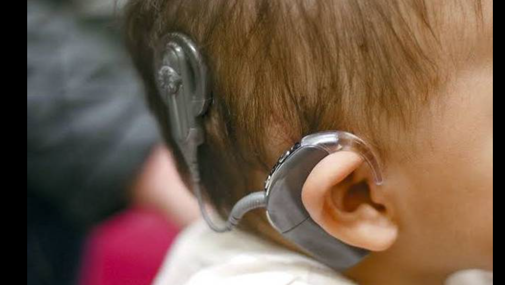 حکومتی نااہلی،سماعت سے محروم سینکڑوں بچوں کا مستقل معذور ہونے کا خدشہ