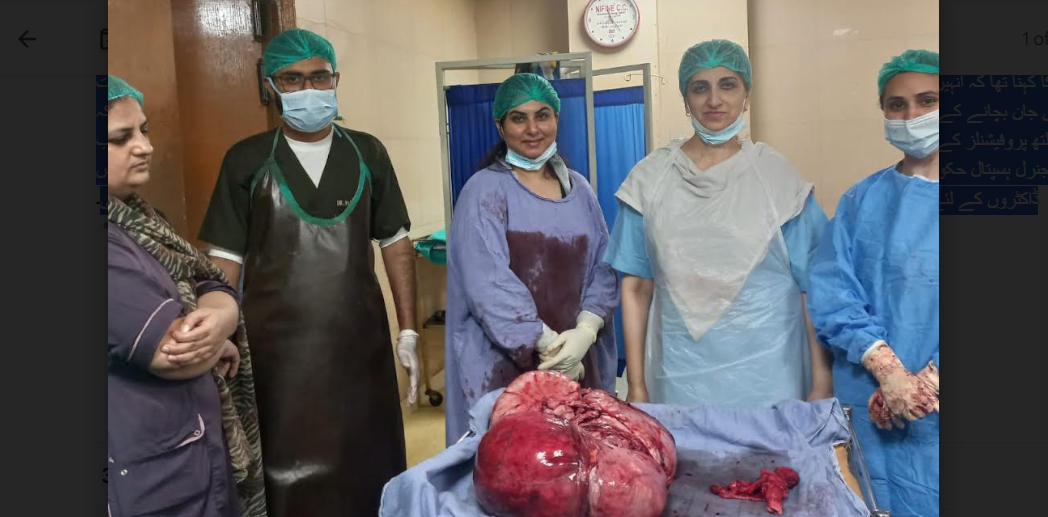 جنرل ہسپتال:دو بچوں کی ماں کی یوٹرس سے 25کلو وزنی رسولی نکالنے کا کامیاب آپریشن