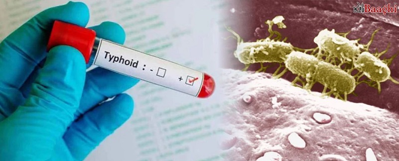 ادویات بے اثر،کیا پاکستان ٹائیفائیڈ لا علاج  ہو چکا ؟
