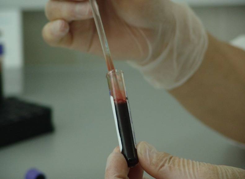 نامعلوم بیماری نے 143 افراد کی جان لے لی