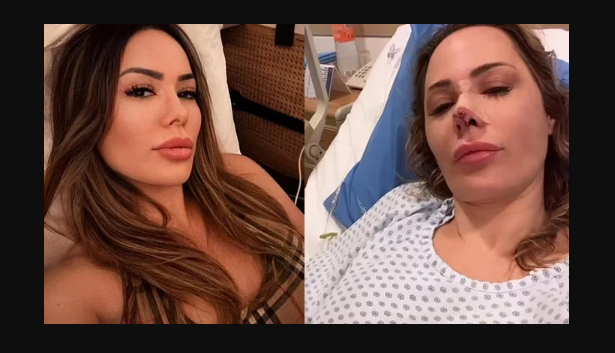 برازیلین ماڈل کو پالتوکتے نے ناک پر  کاٹ لیا