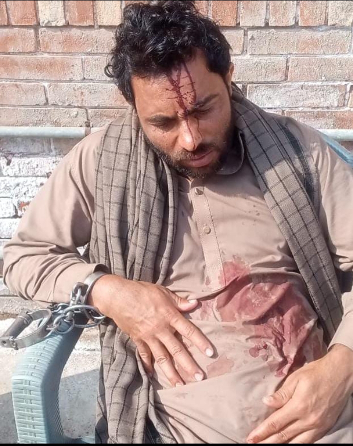 ملزم نے خود کو حوالات میں زخمی کر لیا،اہلکار معطل