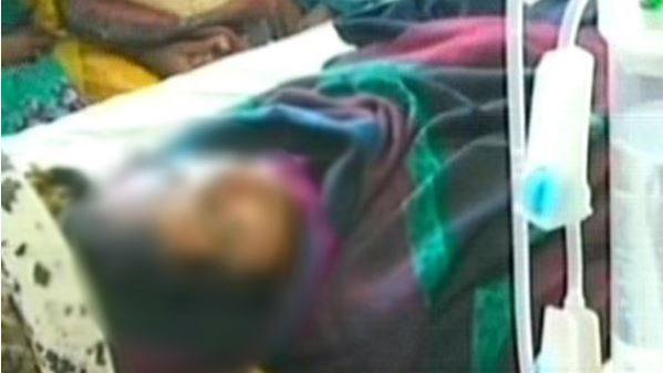 گھر میں سوئی ماں اور  بیٹی پر ملزم  تیزاب پھینک کر فرار