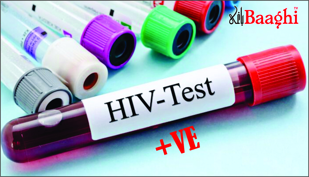 دنیا میں ایچ آئی وی مریضوں کی تعداد 4 کروڑ 80 لاکھ تک پہنچ گئی