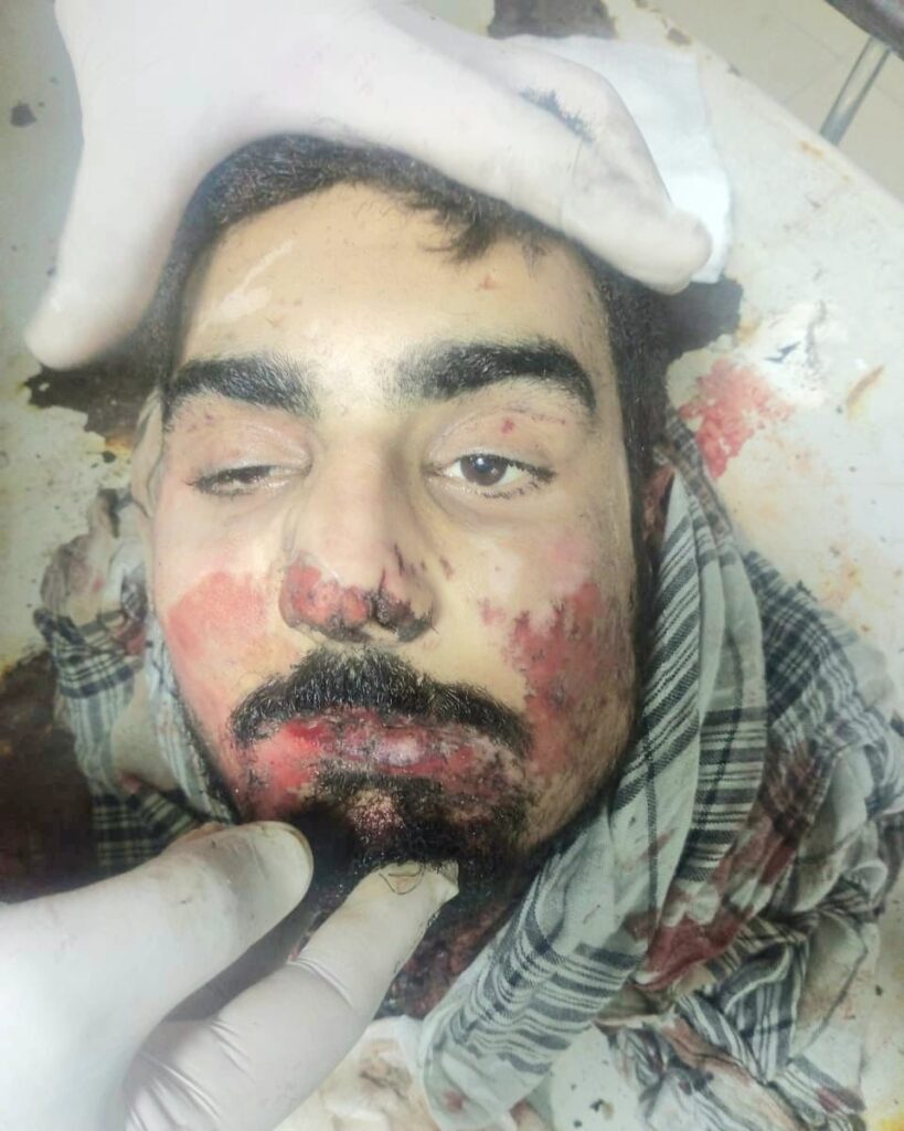 جہنم رسید خودکش بمبار کا چہرہ