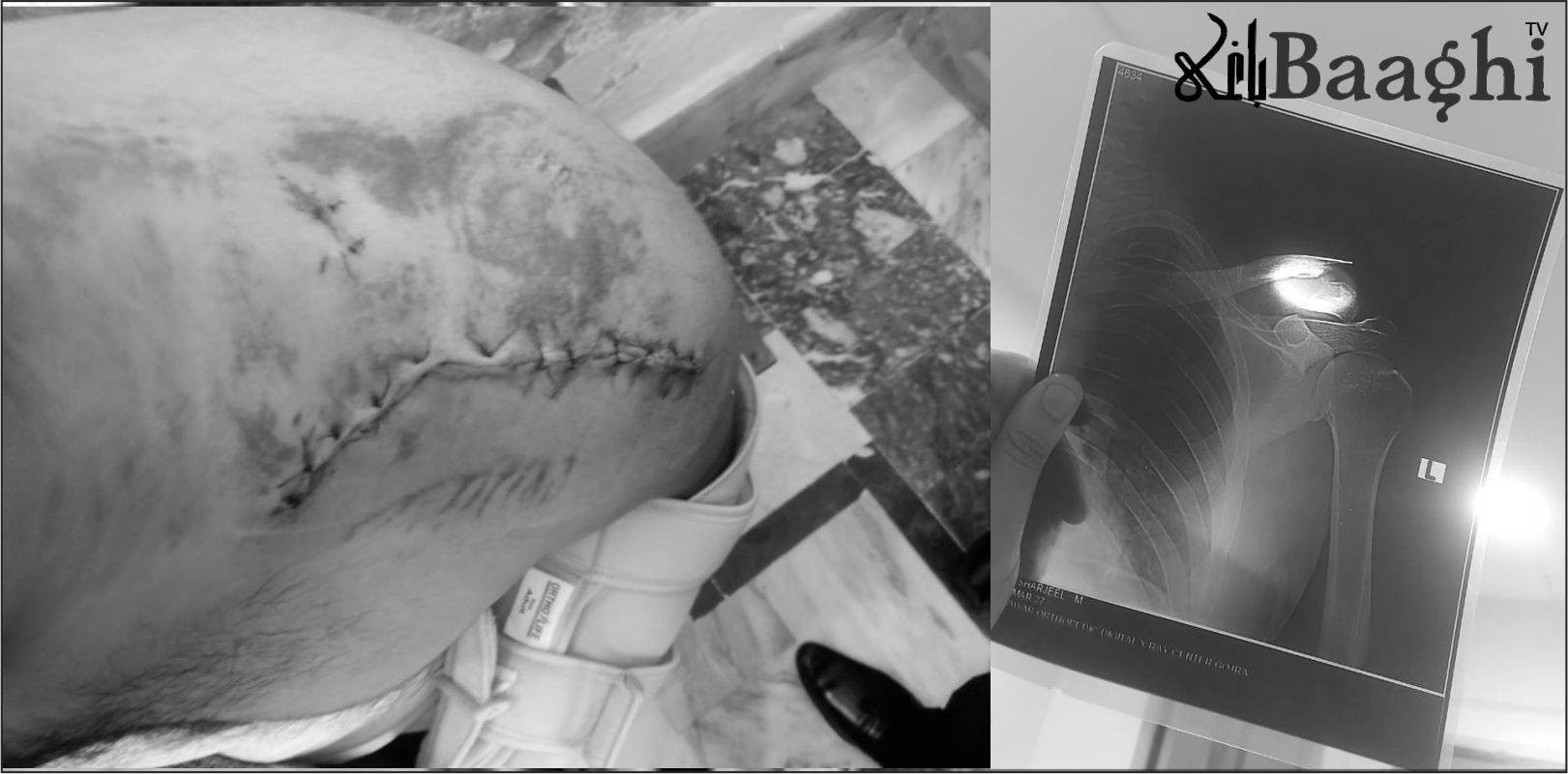 گوجرہ :کچہری کے باہر کتوں کا راج،وکیل زخمی، انتظامیہ بے بس!