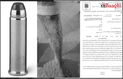 اوچ شریف: بکھری میں اندھی گولی سے شہری زخمی،مقدمہ درج
