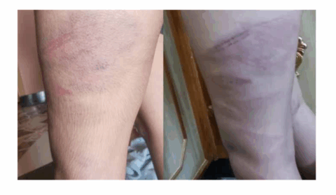 سبق یاد نہ کرنے پر استاد کا طالب علم پر بہیمانہ تشدد