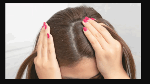 سر میں خشکی،تیل مفید ہے یا نہیں؟ماہرین کی رائے