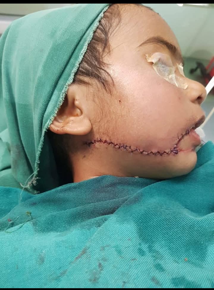 قاتل ڈور کا شکار معصوم بچی کی زندگی خظرے میں،سرجری کر دی گئی