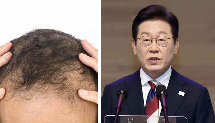 جنوبی کوریا: صدر نے گنج پن کو قومی مسئلہ قرار دے دیا