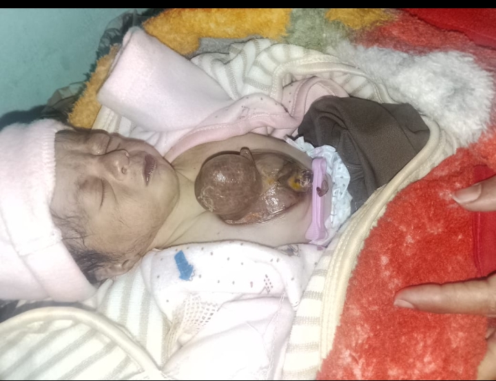 بچے کا دل پیدائشی طور پر جسم کے باہر،بچے کی حالت خطرے میں